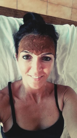 Tratamiento Ayurveda